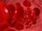 Doctors told about the first signs of thrombosis