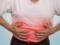 An oncologist named a simple way to get rid of schlub cancer