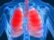 Возможны пневмония и сердечная недостаточность: какие нарушения вызывают цианоз?