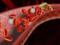 Thrombosis: 6 Signs Your Body Might Have a Potentially Deadly Blood Clot