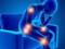 Named three key symptoms of arthritis