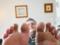 Чемпион мира по борьбе пальцами ног удалил ногти ради соревнований