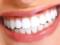 Secrets of a radiant and snow-white smile: dental care