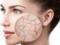 Як покращити стан шкіри на обличчі