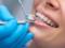 Як зберегти здорові зуби надовго - поради лікарів стоматології Віліда