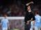 Arteta about defeating Man City: I’m so proud