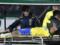 Neymar has a damaged anterior cruciform ligament and a torn meniscus