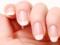 Десять заболеваний, которые могут поведать ногти