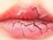 Dry lips: causes and effective solutions