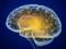 Мозковий імплантант: Відновлення здоров я у боротьбі з епілепсією та ОКР
