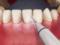 Зубная гигиена: открытие лучшего времени для чистки зубов