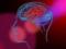 Why workaholics are at risk of stroke